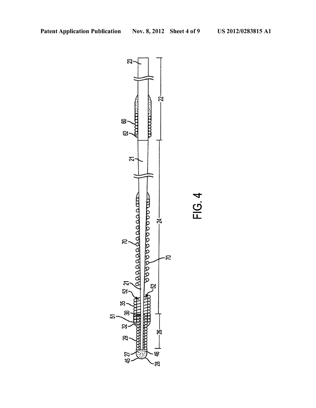 SYSTEM AND METHOD FOR DELIVERING AND DEPLOYING AN OCCLUDING DEVICE WITHIN     A VESSEL - diagram, schematic, and image 05