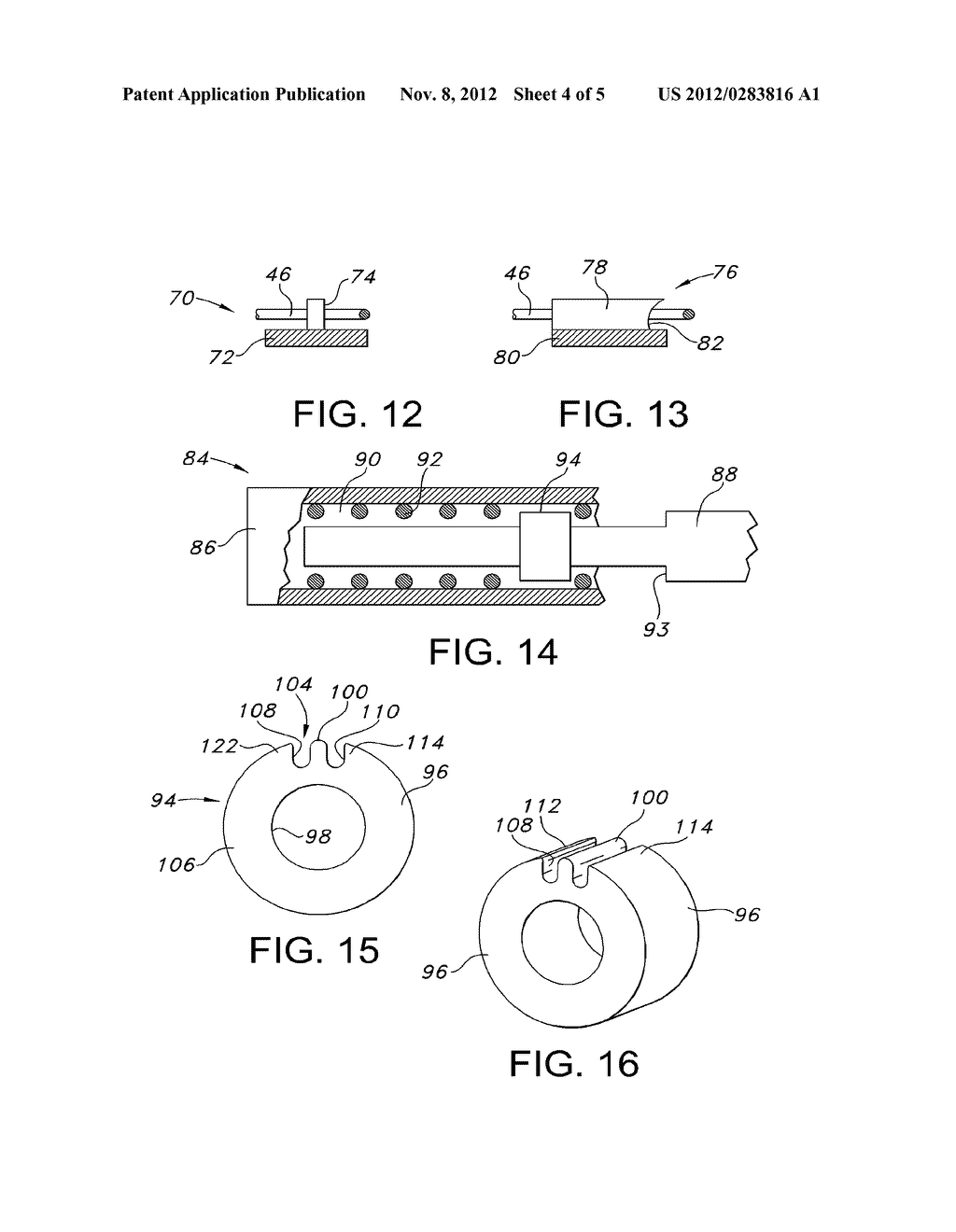 PROSTHESIS ANCHORING AND DEPLOYING DEVICE - diagram, schematic, and image 05