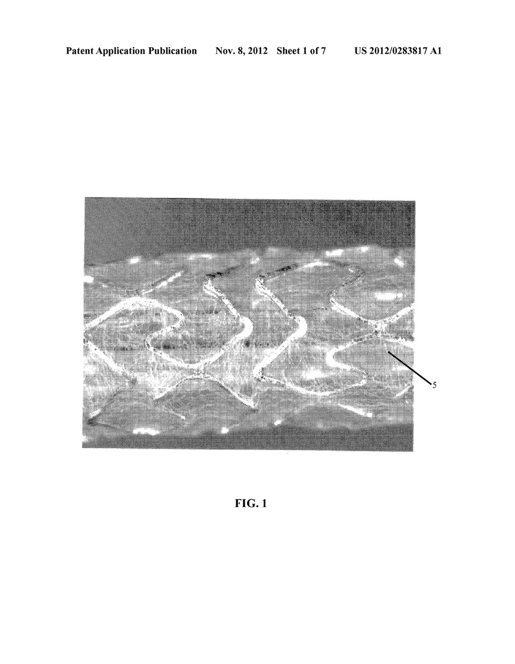 HELICAL HYBRID STENT - diagram, schematic, and image 02