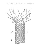 SECURED STRAND END DEVICES diagram and image