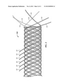 SECURED STRAND END DEVICES diagram and image