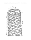 SECURED STRAND END DEVICES diagram and image