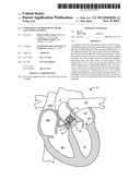 ENDOVASCULAR PROSTHETIC HEART VALVE REPLACEMENT diagram and image