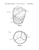 ENDOVASCULAR PROSTHETIC HEART VALVE REPLACEMENT diagram and image