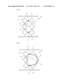 Stent for Protecting Bifurcated Blood Vessels in Bifurcation Lesion diagram and image