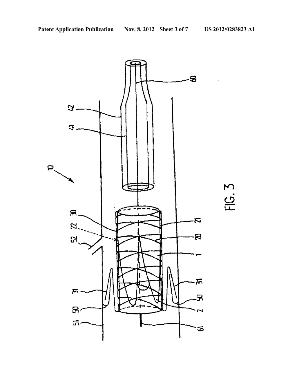 METHODS OF IMPLANTING AN IMPLANTATION DEVICE - diagram, schematic, and image 04