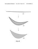 SYSTEMS AND METHODS FOR MASTOPEXY diagram and image