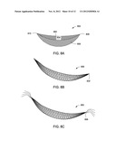 SYSTEMS AND METHODS FOR MASTOPEXY diagram and image