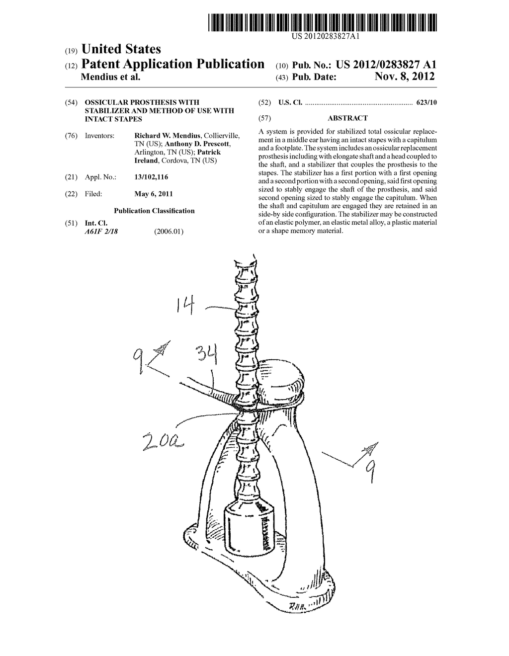 Ossicular Prosthesis with Stabilizer and Method of Use with Intact Stapes - diagram, schematic, and image 01