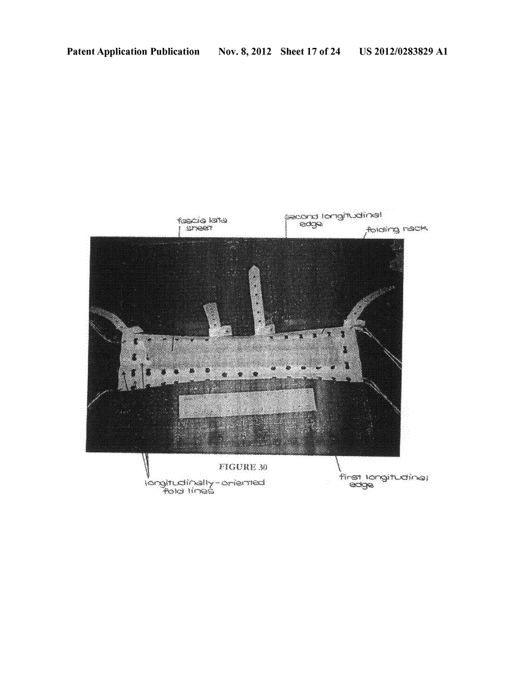 FAN FOLDED FASCIA LATA FOR CRUCIATE LIGAMENT SUBSTITUTION AND METHOD AND     APPARATUS FOR MAKING THE SAME - diagram, schematic, and image 18