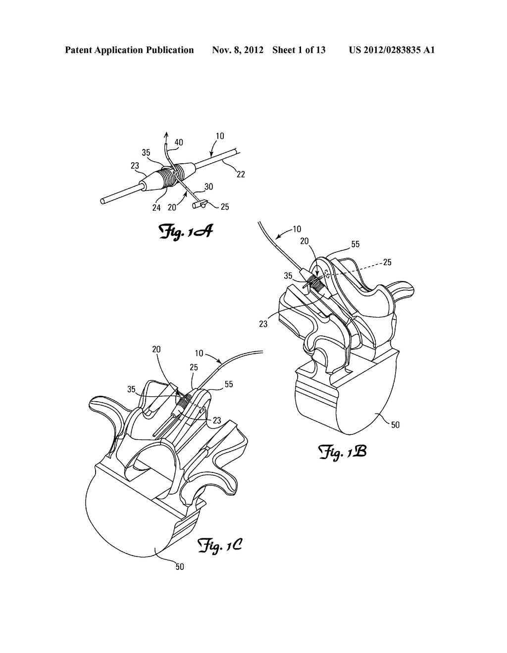 TISSUE FIXATION AND REPAIR SYSTEMS AND METHODS - diagram, schematic, and image 02