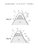 METHODS AND APPARATUS FOR FAI SURGERIES diagram and image