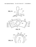 METHODS AND APPARATUS FOR FAI SURGERIES diagram and image