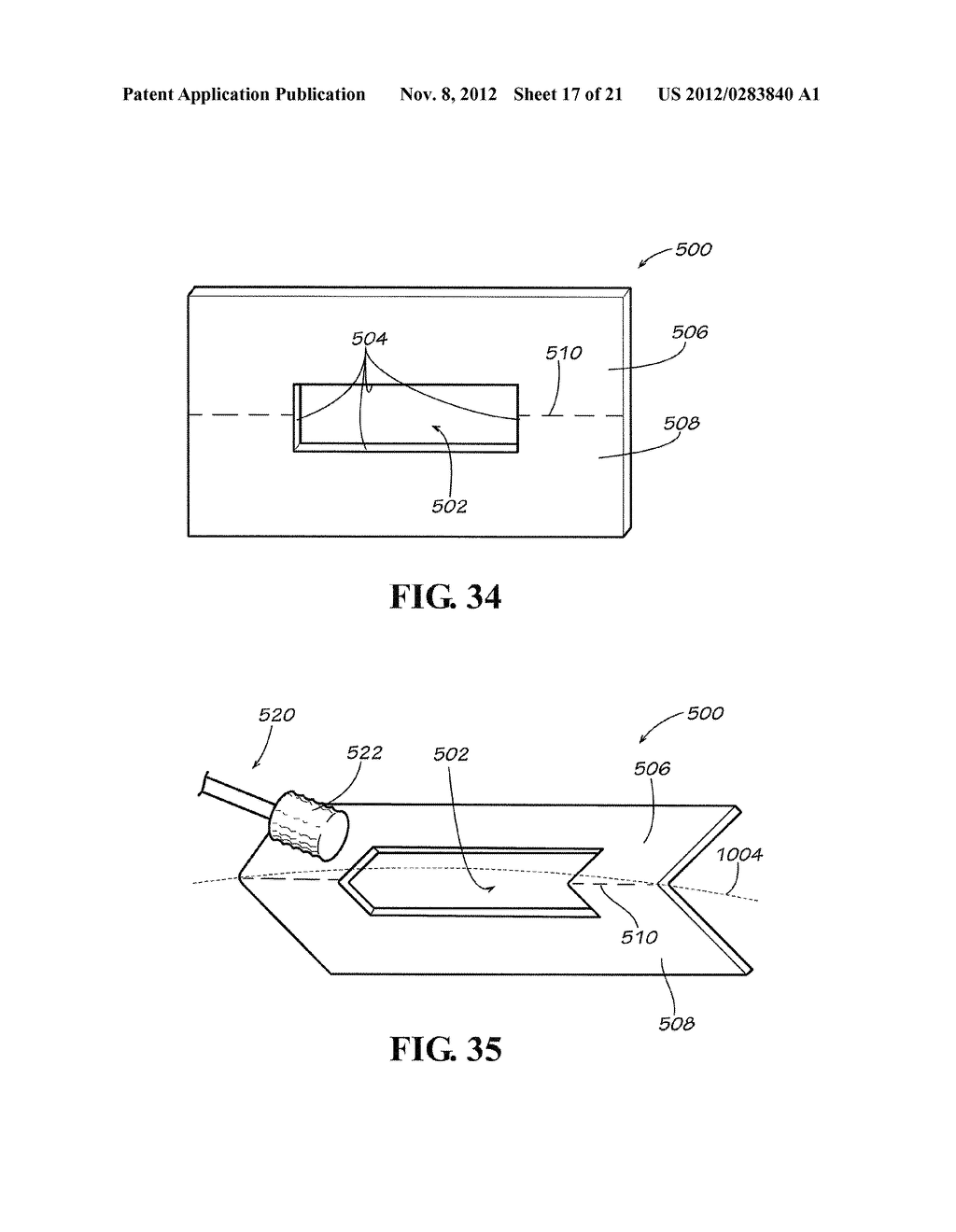 METHODS AND APPARATUS FOR FAI SURGERIES - diagram, schematic, and image 18