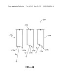 METHODS AND APPARATUS FOR FAI SURGERIES diagram and image