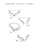 ESOPHAGEAL VALVE DEVICE FOR PLACING IN THE CARDIA diagram and image