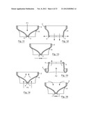 ESOPHAGEAL VALVE DEVICE FOR PLACING IN THE CARDIA diagram and image