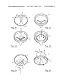 ESOPHAGEAL VALVE DEVICE FOR PLACING IN THE CARDIA diagram and image