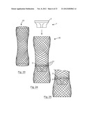 ESOPHAGEAL VALVE DEVICE FOR PLACING IN THE CARDIA diagram and image