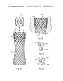 ESOPHAGEAL VALVE DEVICE FOR PLACING IN THE CARDIA diagram and image