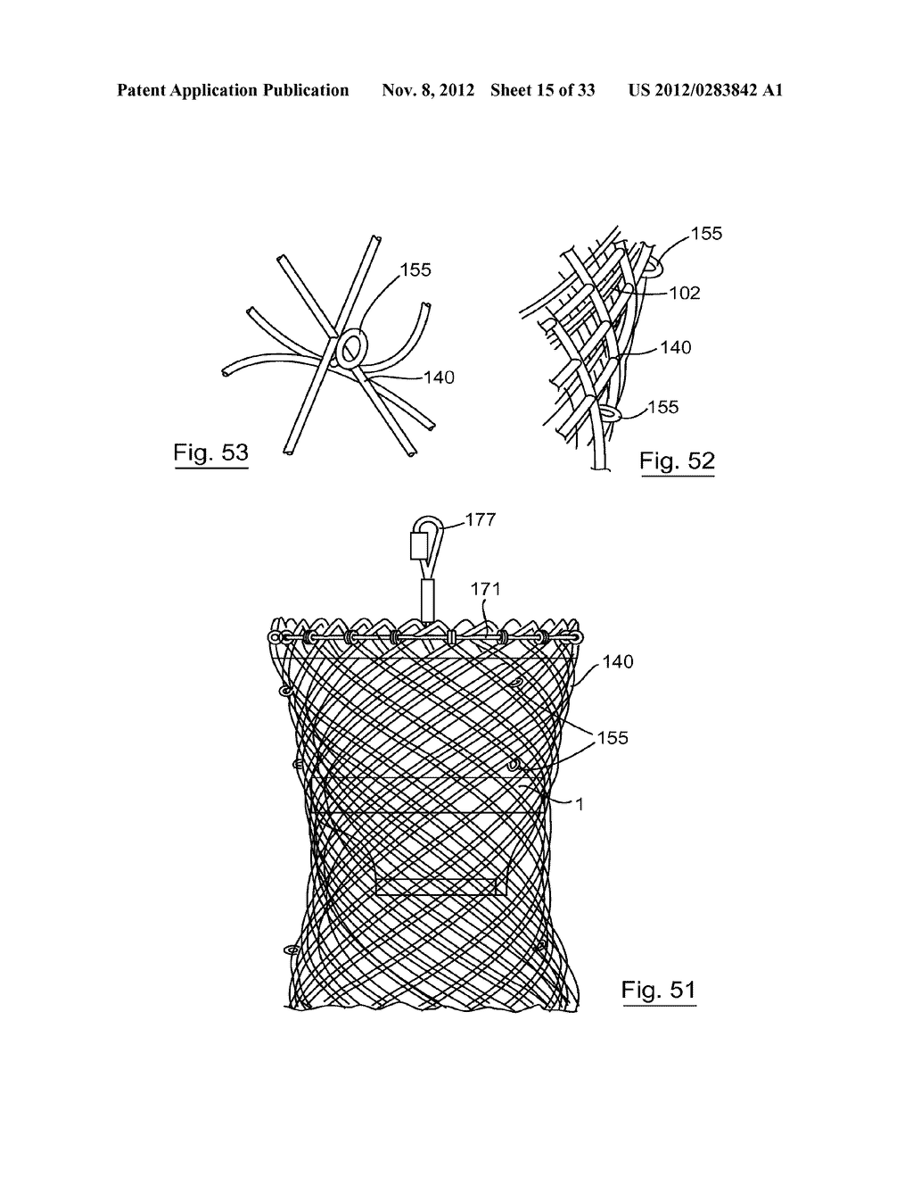 ESOPHAGEAL VALVE DEVICE FOR PLACING IN THE CARDIA - diagram, schematic, and image 16