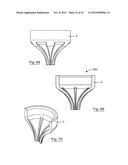 ESOPHAGEAL VALVE DEVICE FOR PLACING IN THE CARDIA diagram and image