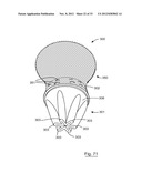 ESOPHAGEAL VALVE DEVICE FOR PLACING IN THE CARDIA diagram and image