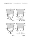 ESOPHAGEAL VALVE DEVICE FOR PLACING IN THE CARDIA diagram and image