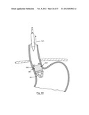 ESOPHAGEAL VALVE DEVICE FOR PLACING IN THE CARDIA diagram and image