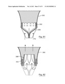 ESOPHAGEAL VALVE DEVICE FOR PLACING IN THE CARDIA diagram and image