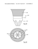 ESOPHAGEAL VALVE DEVICE FOR PLACING IN THE CARDIA diagram and image