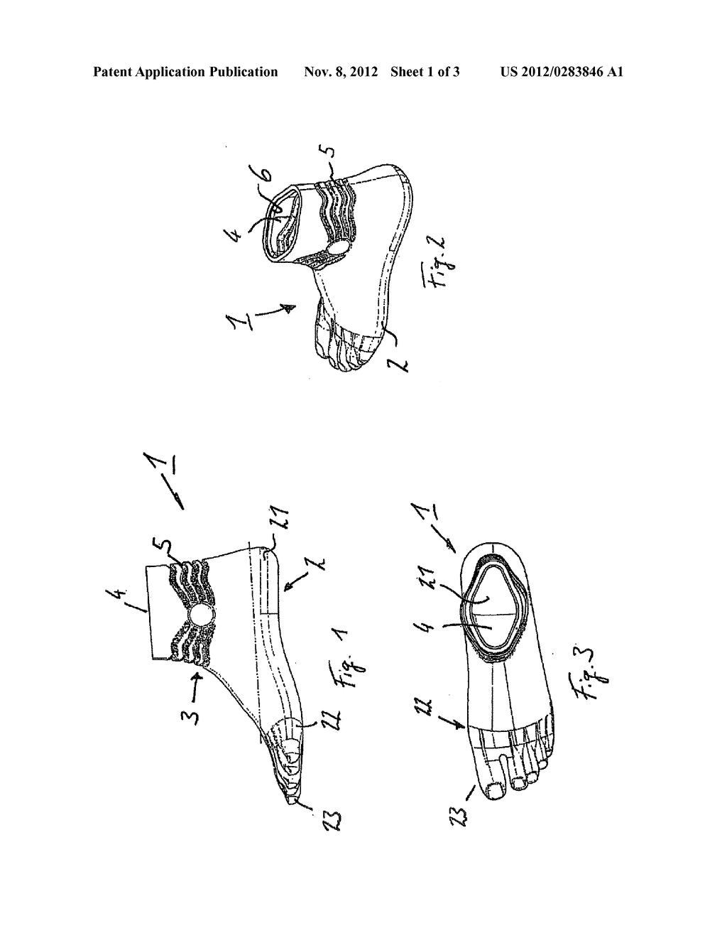 ARTIFICIAL LIMB CASING AND METHOD FOR THE PRODUCTION THEREOF - diagram, schematic, and image 02
