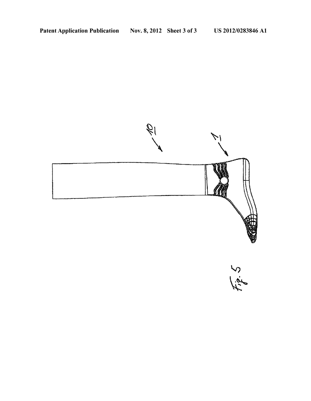 ARTIFICIAL LIMB CASING AND METHOD FOR THE PRODUCTION THEREOF - diagram, schematic, and image 04