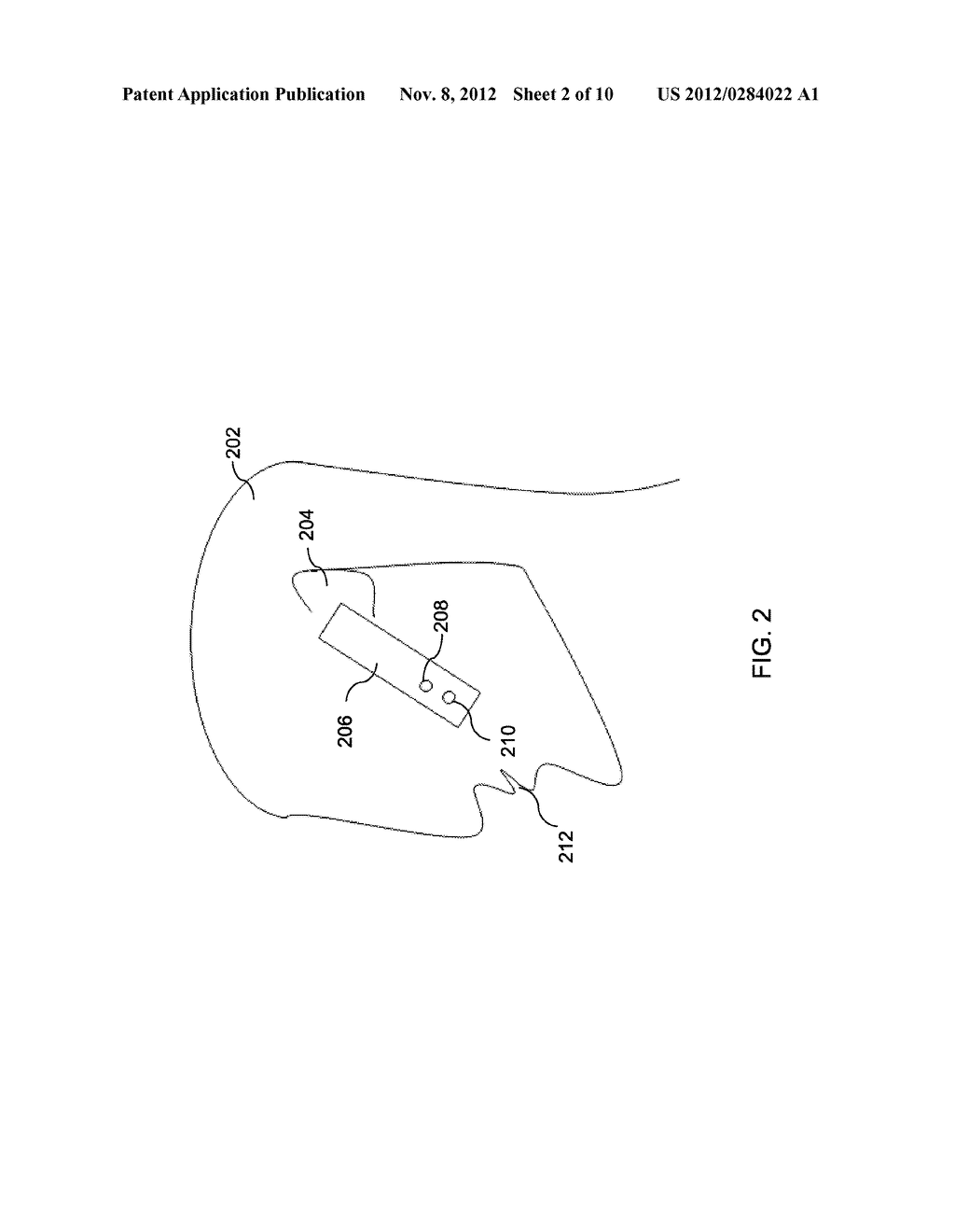 NOISE REDUCTION SYSTEM USING A SENSOR BASED SPEECH DETECTOR - diagram, schematic, and image 03