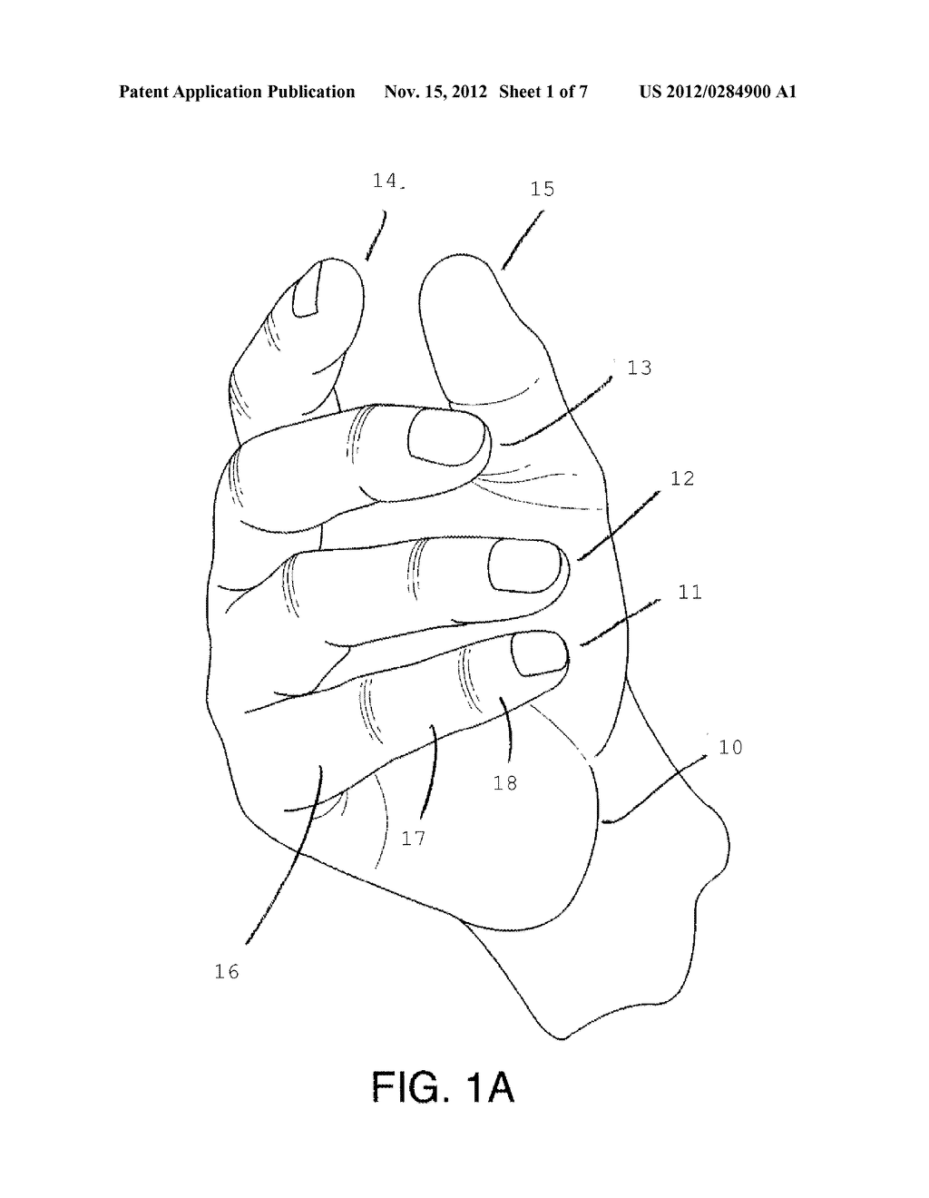Glove to Resist Nocturnal Hand Curling - diagram, schematic, and image 02