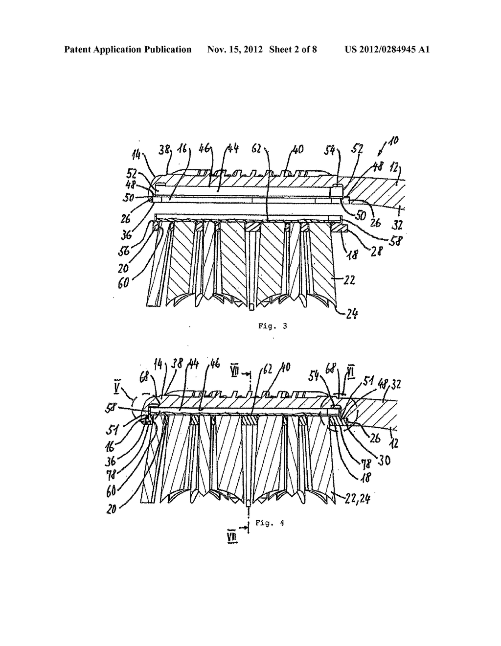 METHOD FOR PRODUCING A TOOTHBRUSH AND TOOTHBRUSH - diagram, schematic, and image 03