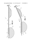 STRING CLEANING SYSTEM diagram and image