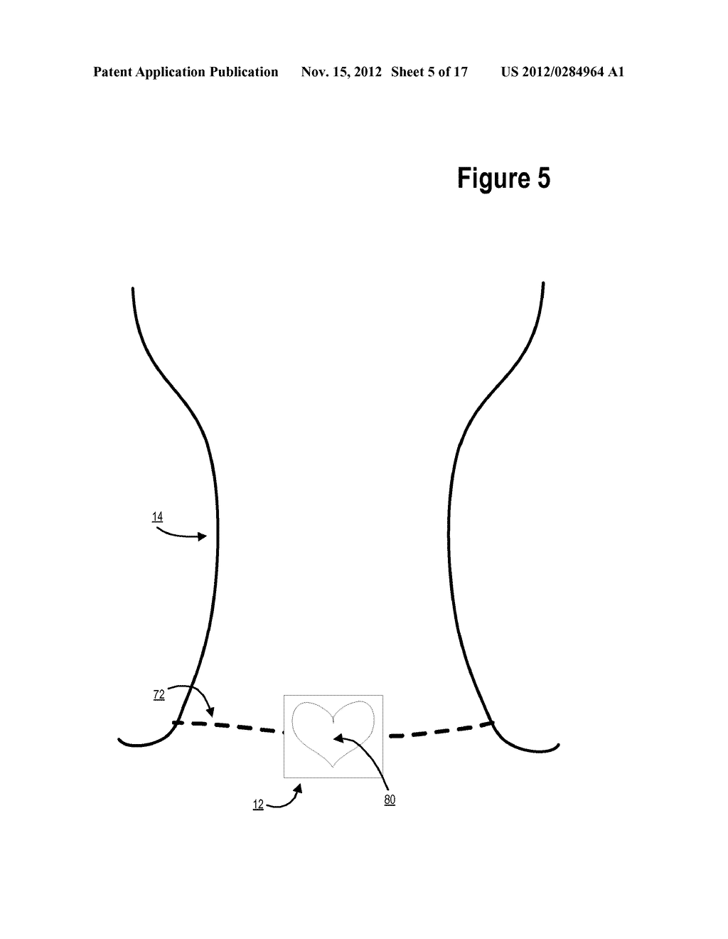 DEVICE FOR POSITIONING A NECKLACE - diagram, schematic, and image 06