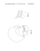 Bone Plate Manufacturing Method diagram and image