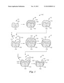 METHODS FOR MAKING LAYERED DENTAL APPLIANCES diagram and image