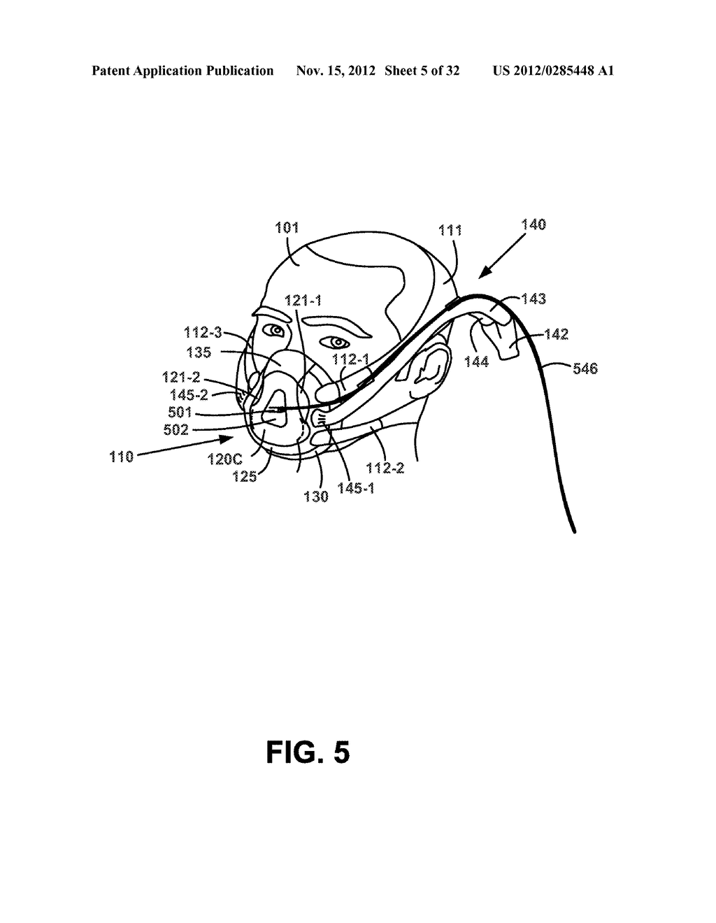 TUBE PLACEMENT IN NON-INVASIVE VENTILATION - diagram, schematic, and image 06