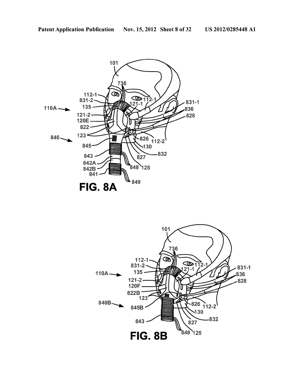 TUBE PLACEMENT IN NON-INVASIVE VENTILATION - diagram, schematic, and image 09