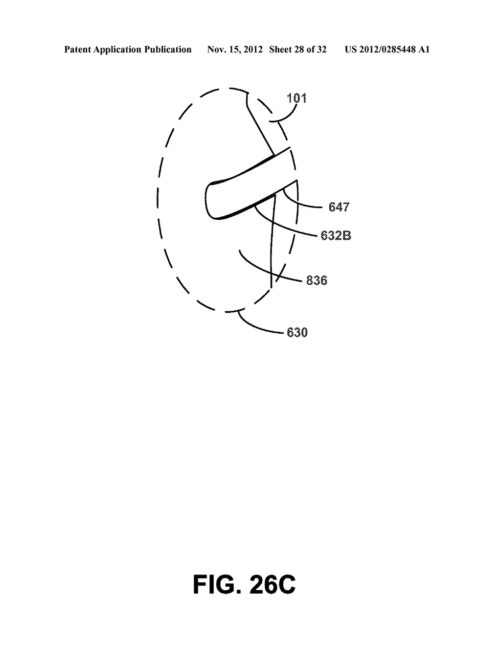 TUBE PLACEMENT IN NON-INVASIVE VENTILATION - diagram, schematic, and image 29