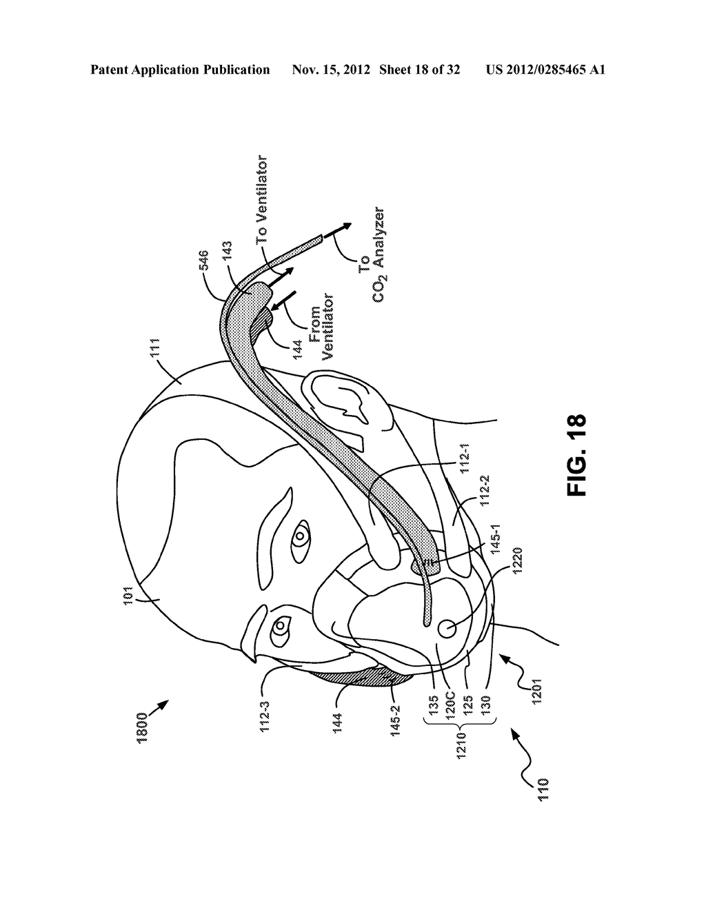 NON-INVASIVE VENTILATION FACIAL SKIN PROTECTION - diagram, schematic, and image 19