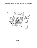 NASAL PASSAGE OPENER OF A VENTILATION MASK diagram and image