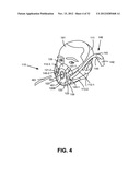 NASAL PASSAGE OPENER OF A VENTILATION MASK diagram and image