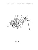 NASAL PASSAGE OPENER OF A VENTILATION MASK diagram and image