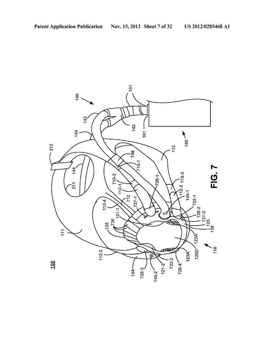 NASAL PASSAGE OPENER OF A VENTILATION MASK - diagram, schematic, and image 08