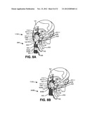 NASAL PASSAGE OPENER OF A VENTILATION MASK diagram and image