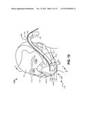 NASAL PASSAGE OPENER OF A VENTILATION MASK diagram and image